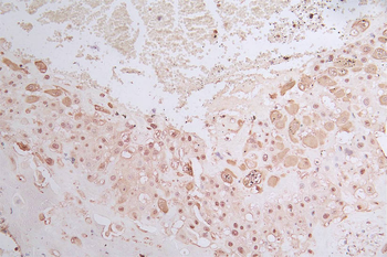GAPDH Antibody