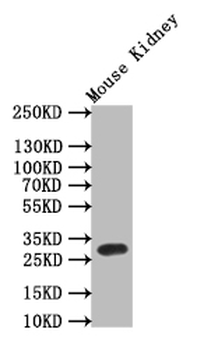 TPSB2 Antibody