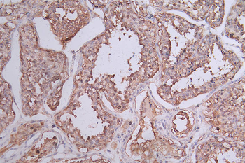 HSP90AB1 Antibody