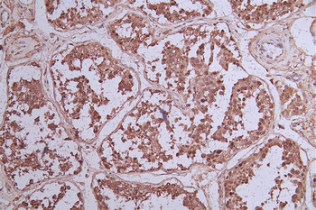 BCL6 Antibody