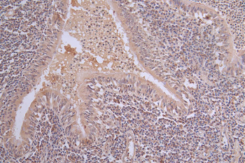 PIK3R1 Antibody