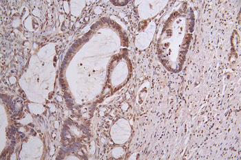 PIK3R1 Antibody