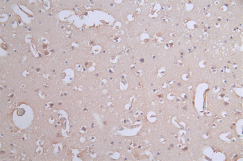 PXN Antibody