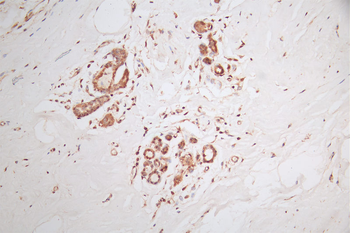 DYNLL1 Antibody
