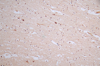 MDM2 Antibody