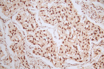 MDM2 Antibody