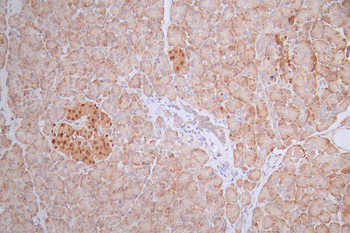 PAX6 Antibody