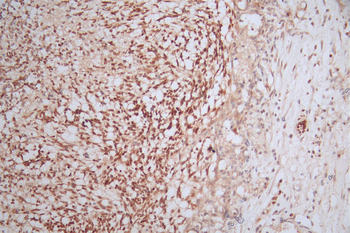PAX6 Antibody