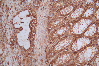 CD44 Antibody