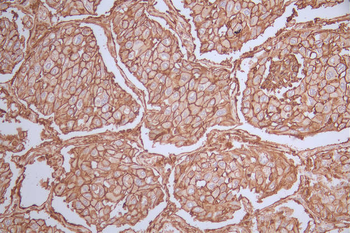 CD44 Antibody