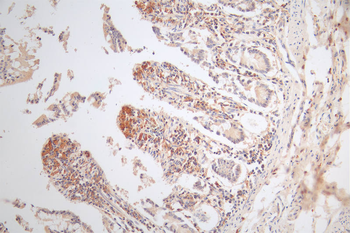 MICA Antibody
