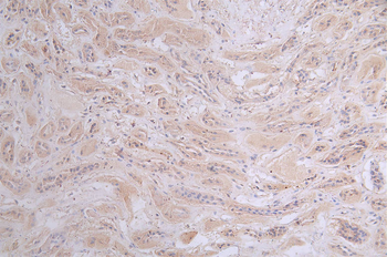 PRKAR2A Antibody