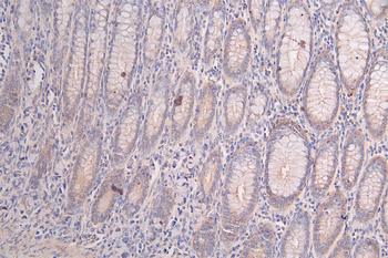 PRKAR2A Antibody