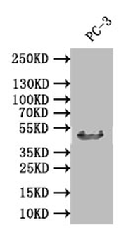 DDB2 Antibody
