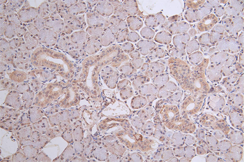 DDB2 Antibody