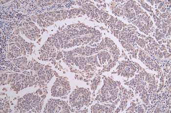 DDB2 Antibody