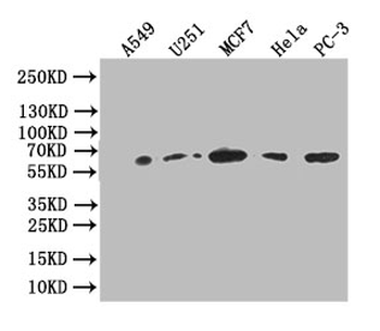GPI Antibody
