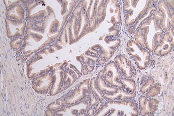 GPI Antibody