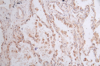 GPI Antibody