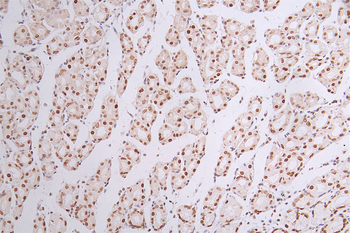 SMARCA4 Antibody