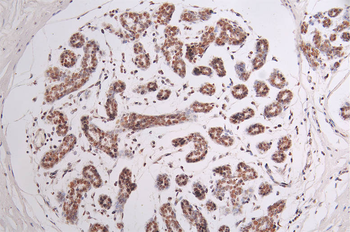 SMARCA4 Antibody
