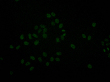 SMARCA4 Antibody