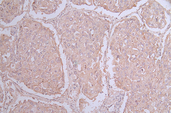 PVR Antibody