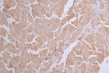 ATP2A2 Antibody