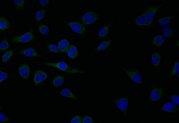 ATP2A2 Antibody