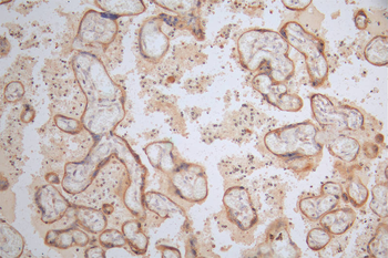 LAMP2 Antibody