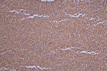 CA1 Antibody