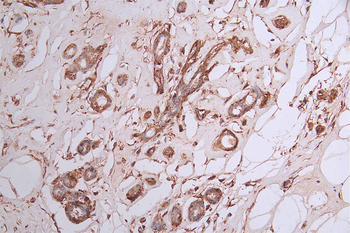 DPYSL2 Antibody
