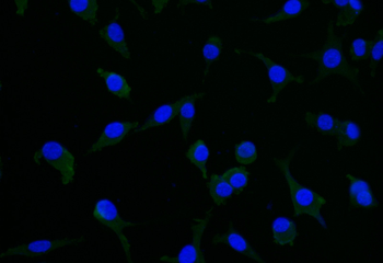 DPYSL2 Antibody