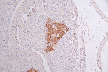 KRT10 Antibody