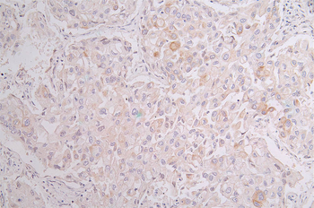 KRT10 Antibody