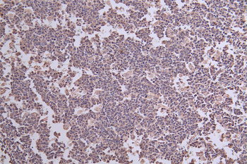 THEMIS Antibody