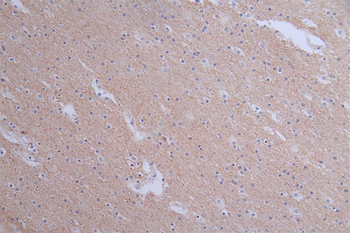 PANX1 Antibody