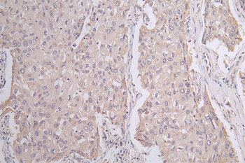 PANX1 Antibody