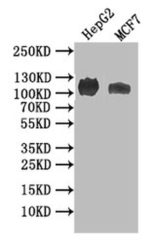 NPR2 Antibody