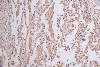 LGR6 Antibody