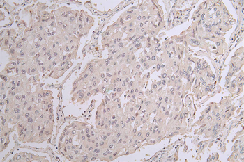 CHAT Antibody
