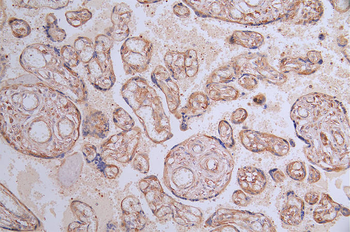 FLT1 Antibody