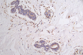 FLT1 Antibody