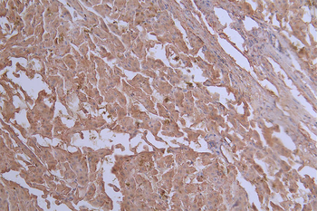 SLC2A2 Antibody