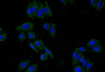 SLC2A2 Antibody