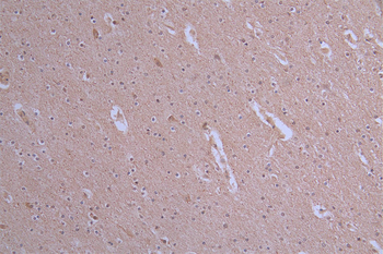 ATP7B Antibody