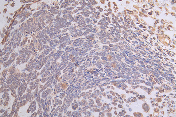 ATP7B Antibody