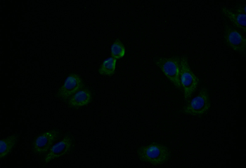ATP7B Antibody