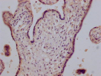 CD147 Antibody