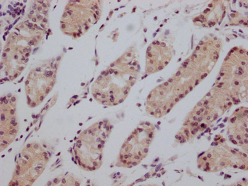 CD147 Antibody